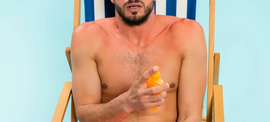 Come prevenire l’eritema solare in estate