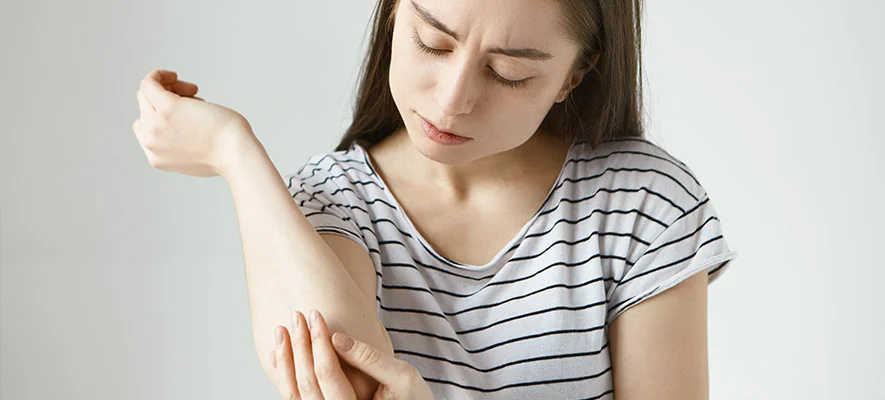 Psoriasi: cos’è e come si cura